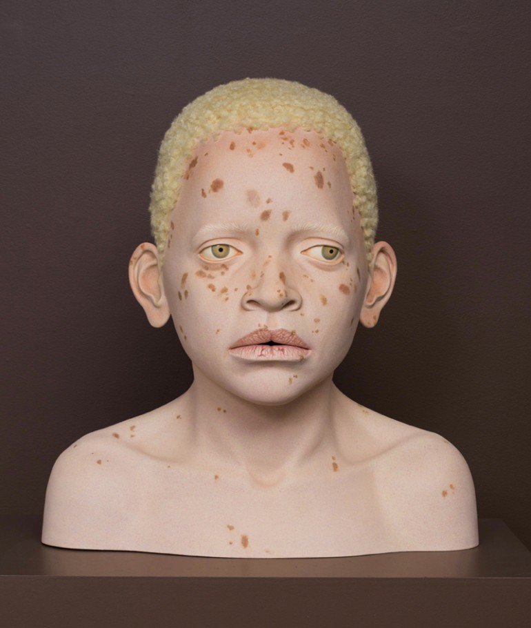 Sculpture for African Children with Albinism